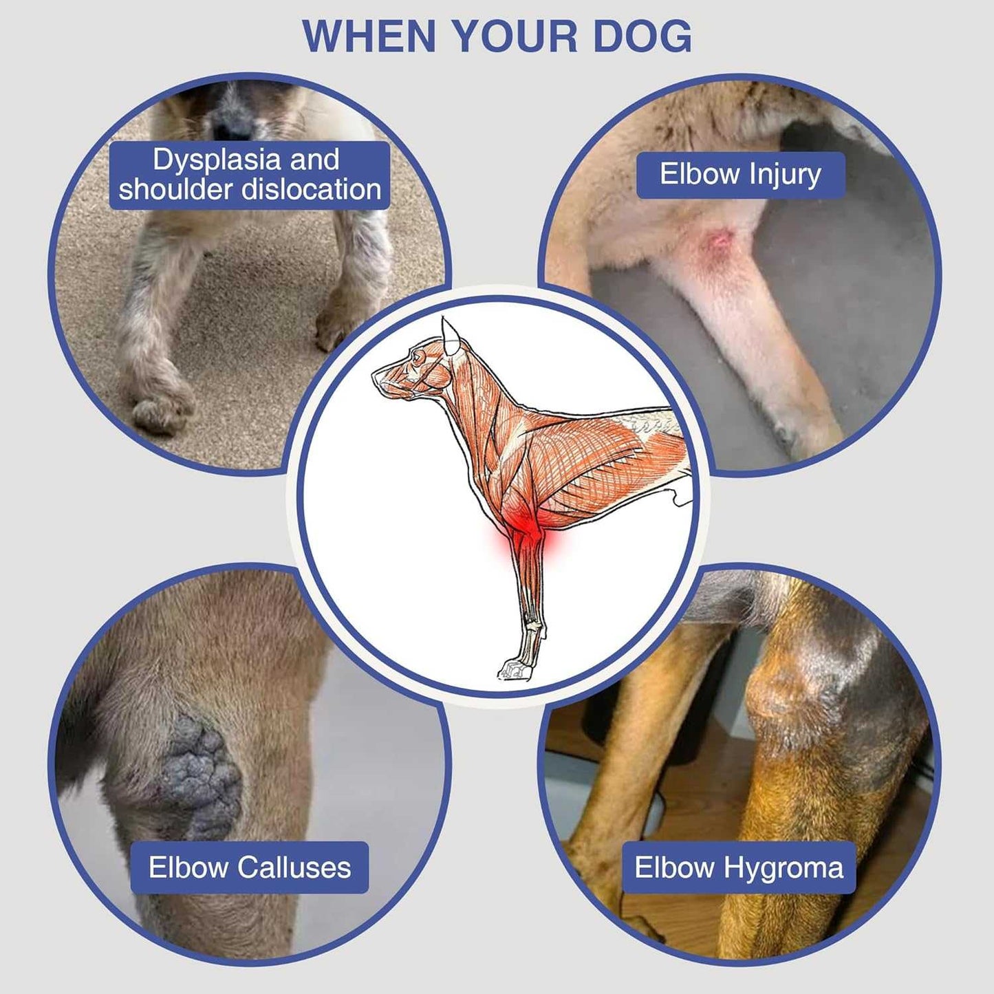 Hilltown Dog Elbow Brace XL for Shoulder Dislocation, Leg Injury, Arthritis Support NA252-002
